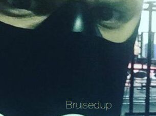Bruisedup