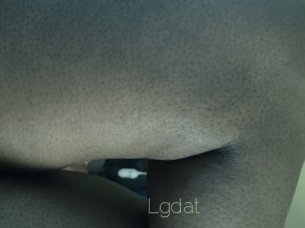 Lgdat