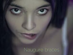 Nauguire_braces