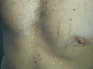 sexto Visio Tchats