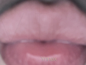 Ynnax